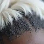 Haarwachstum nach dem Bleichen