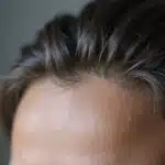 Was tun bei den ersten grauen Haaren?