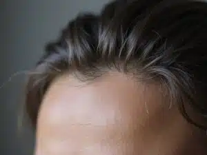 erste graue Haare behandeln
