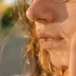 Teen Haut im Fokus – Unsere Behandlung für Teens