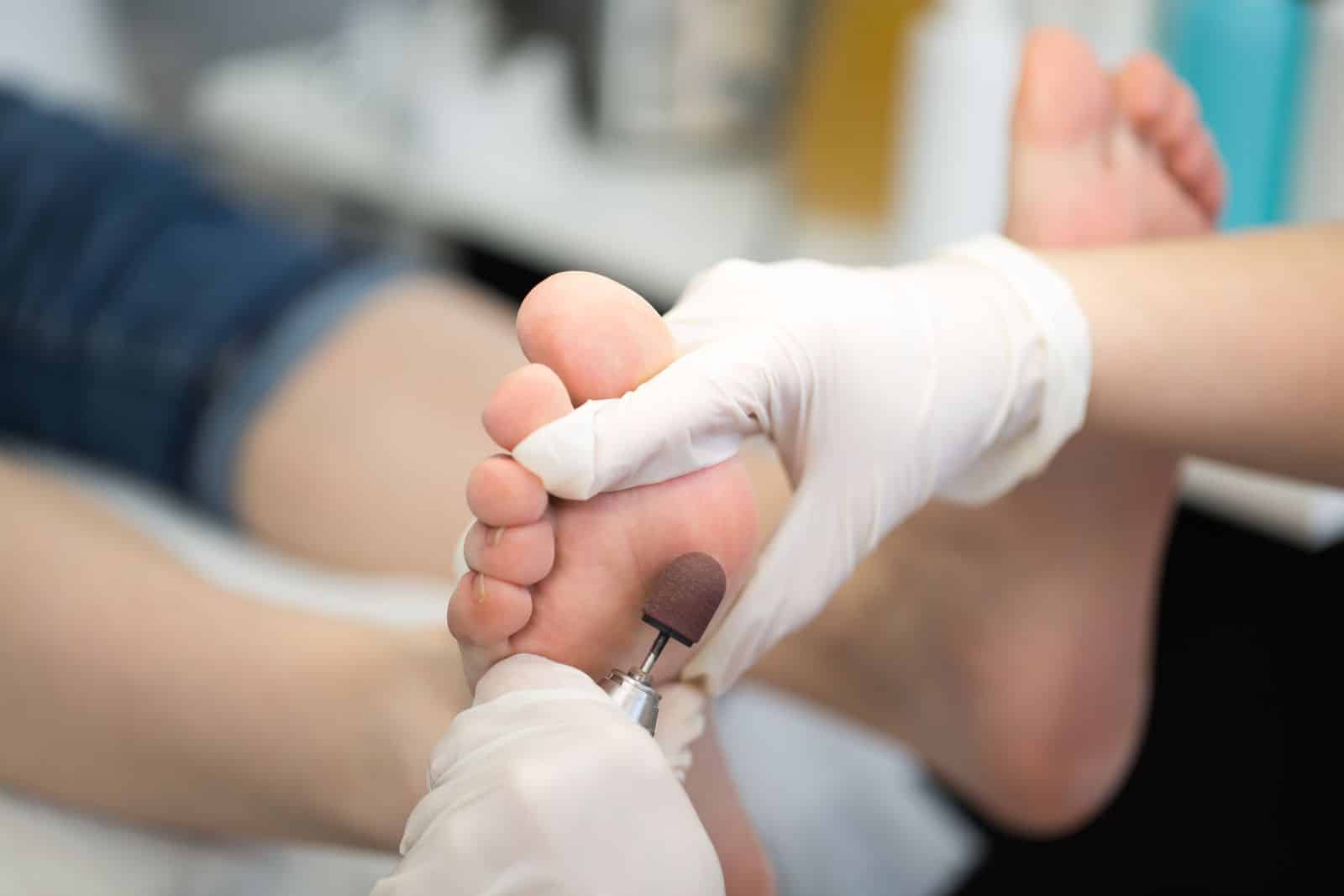 medizinische Fußpflegeleistungen in Husby